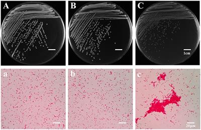 Tetrahymena thermophila Predation Enhances Environmental Adaptation of the Carp Pathogenic Strain Aeromonas hydrophila NJ-35